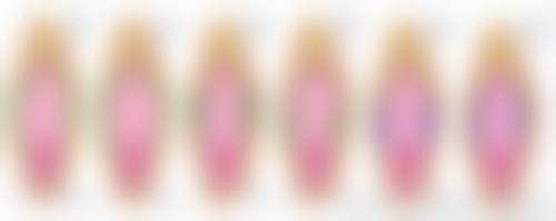 徐州懿薇莱美容真实实例：美丽看得见