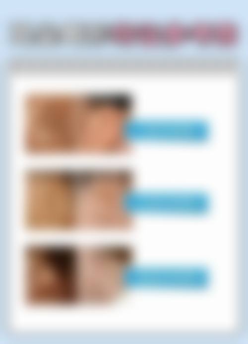 徐州懿薇莱美容口碑怎么样：顾客见证美丽奇迹