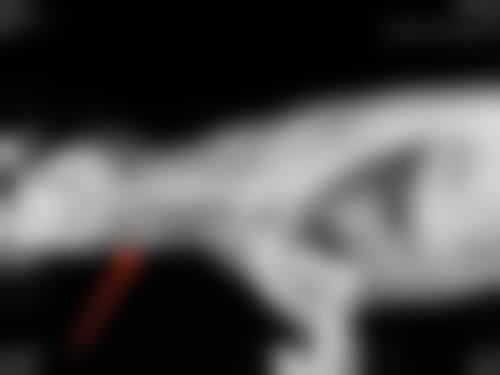 上海伊美尔港华医疗美容医院真实实例