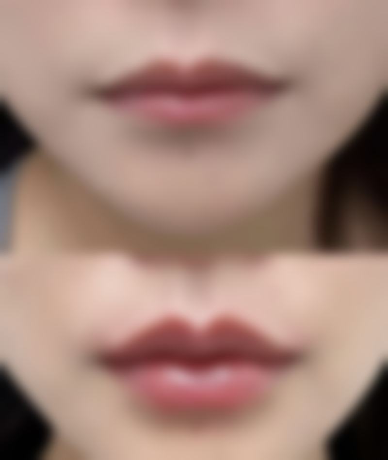 莆田女人花整形医院营业时间:方便你的美丽计划