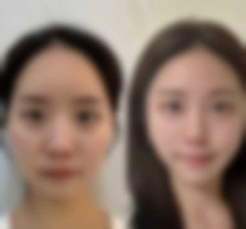 莆田女人花整形医院口碑怎么样:真实评价见证实力