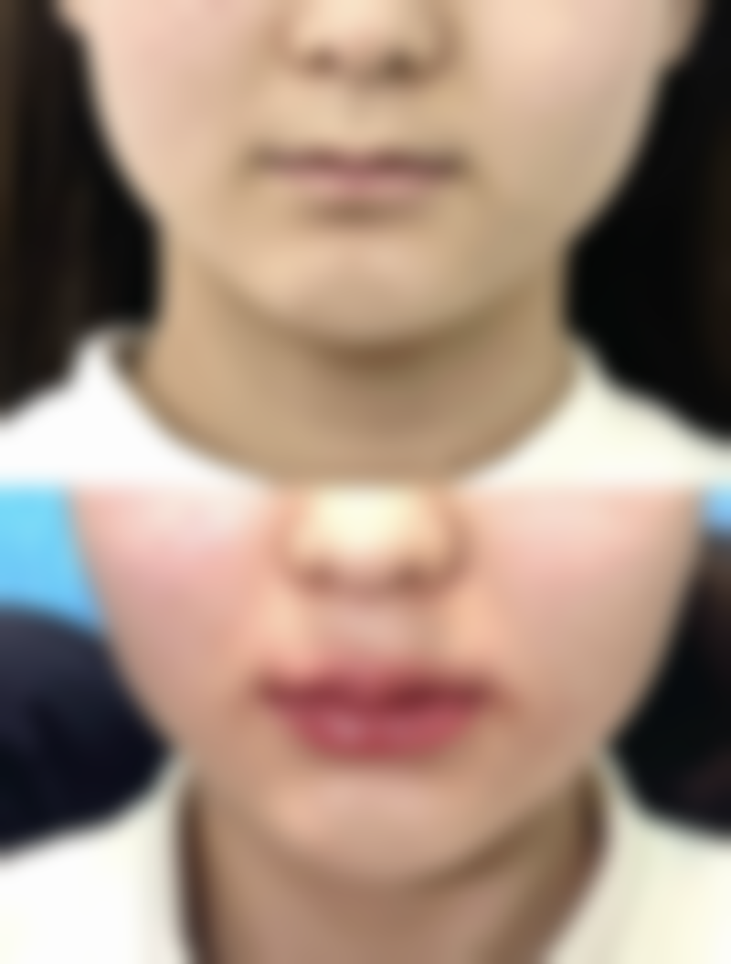 四川成都美容整形医院私密科李挺医生口碑靠谱吗