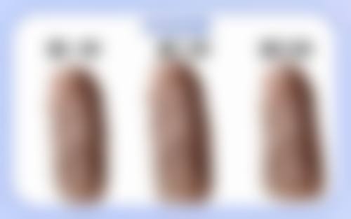 福清东南眼科医院改善双眼皮松弛值不值?