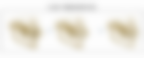 清潭Eclatde医院真实实例:治疗前后的惊人变化!