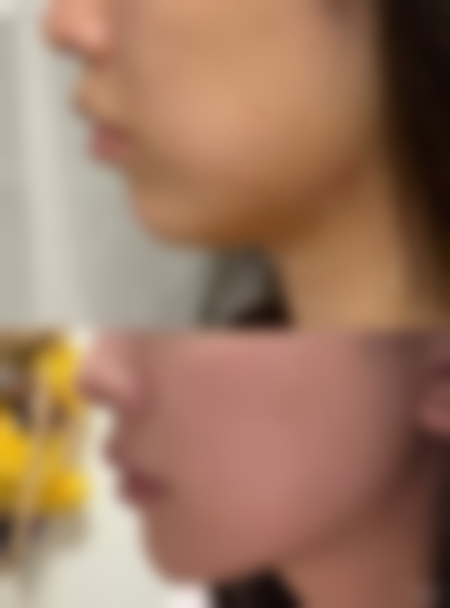 新余香溋医疗美容门诊部真实实例