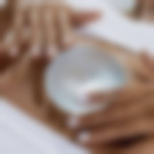 安阳亦美医疗美容真实实例