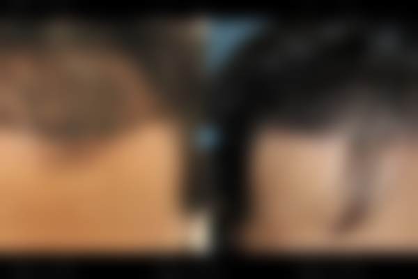 韩国毛杰琳整形外科医生名单：专精团队实力强