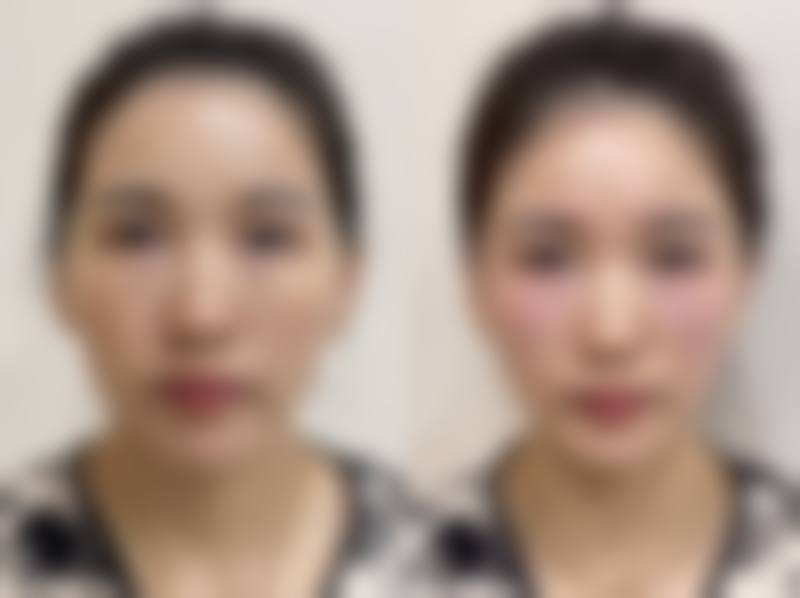 刘医生坐诊医院:高端医美新体验