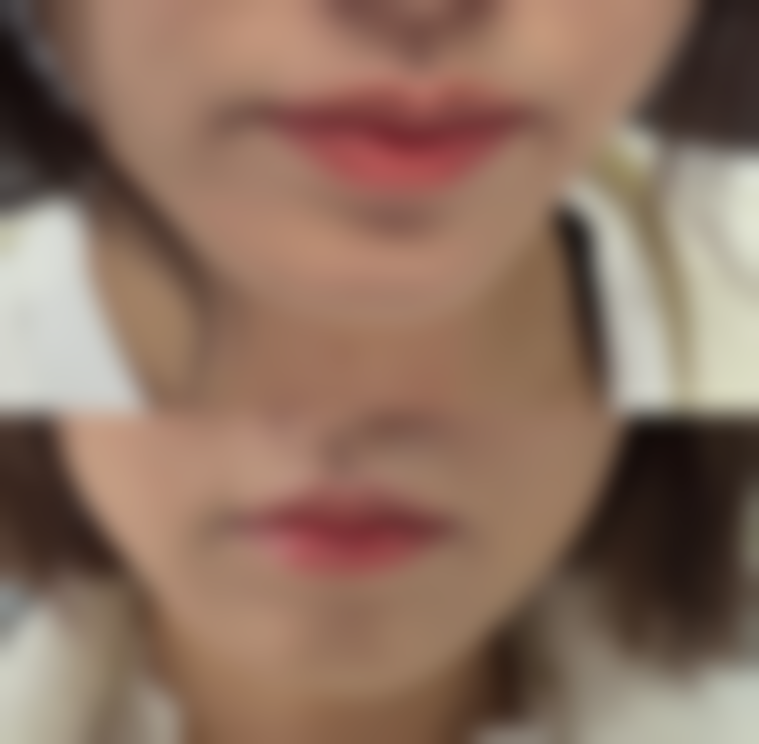 呼和浩特科益人医疗美容诊所价格表：透明合理消费