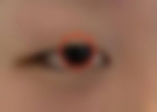 艾斯美隆胸假体柔软度适合吗？