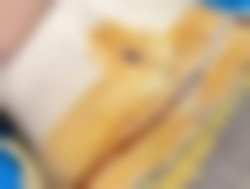 北京嘉禾医疗美容改善小孩积食眼袋深适合吗？