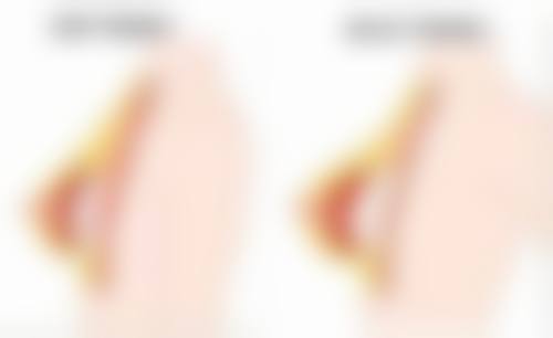 高旭医生真实实例