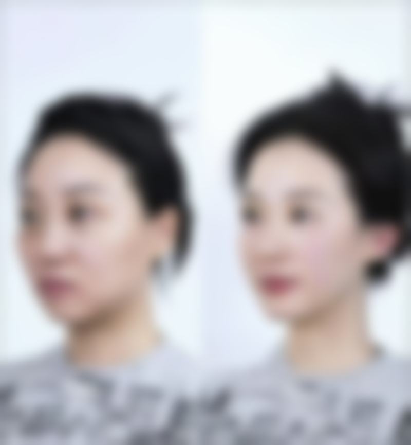 浙江台州爱莱美医疗美容门诊部口碑怎么样