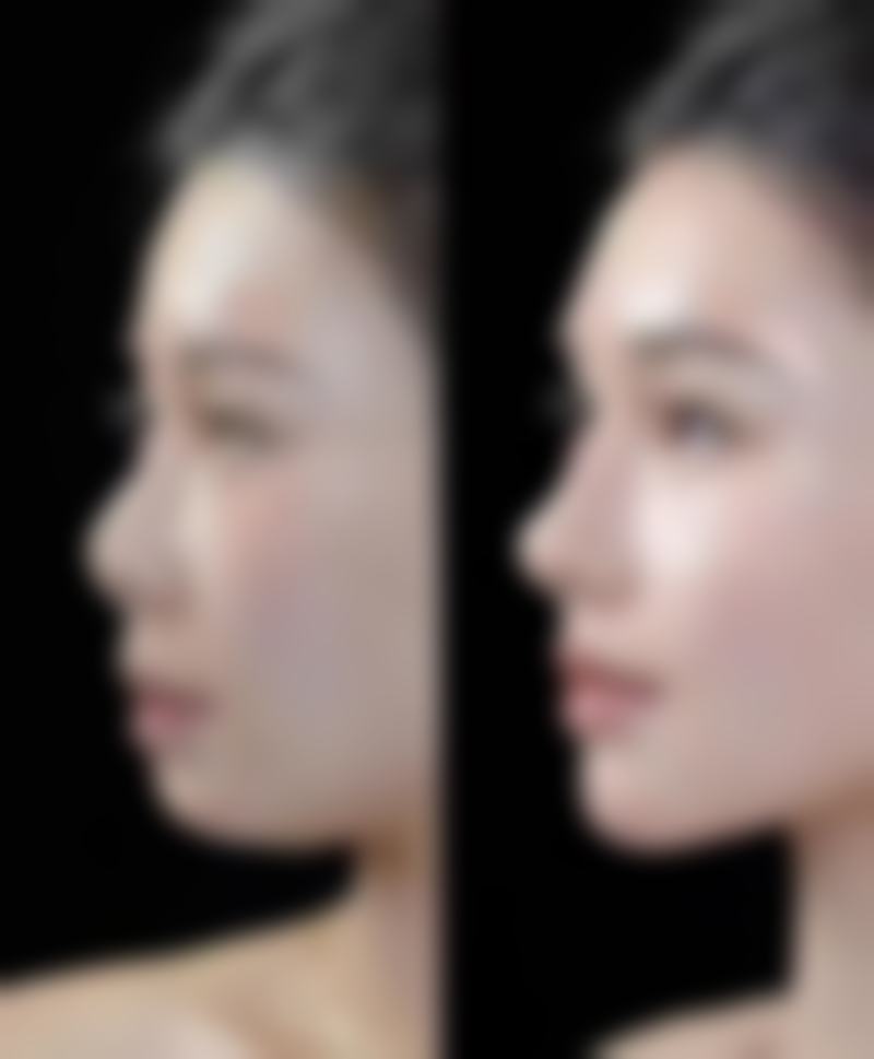 运城华美整形美容医院电话号码