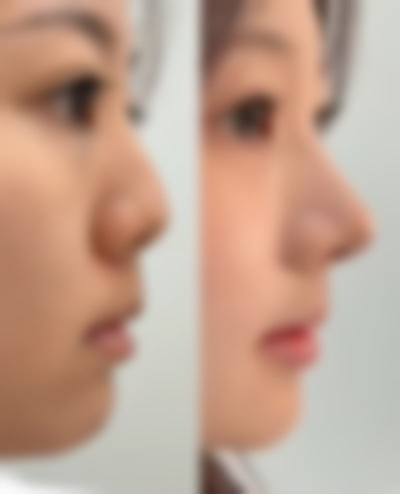 北京李医生整形医疗美容诊所擅长项目