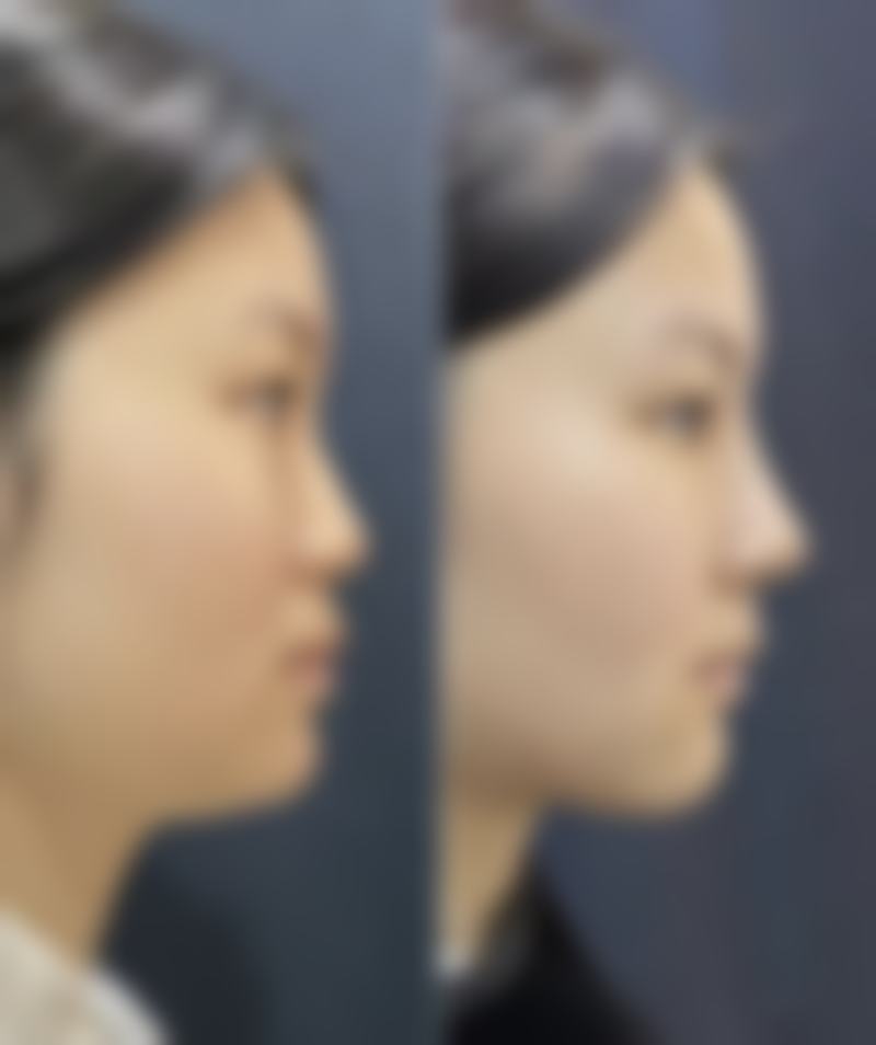 贵州贝拉医疗美容诊所真实实例：见证美丽蜕变