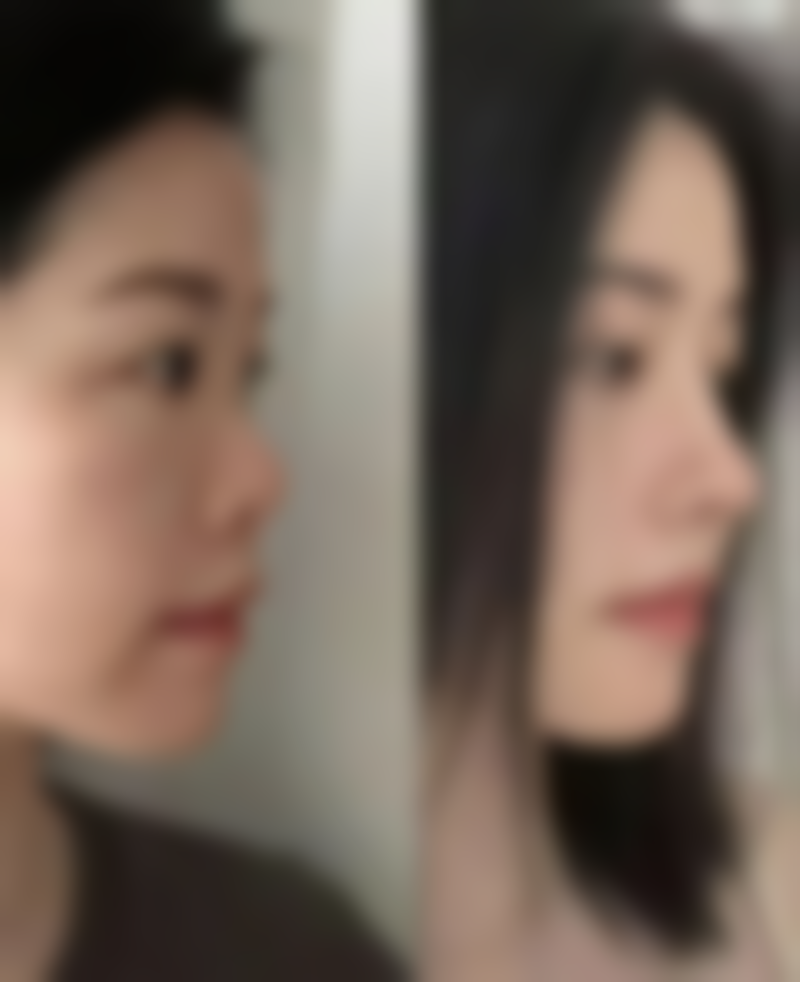 广州东方医院肿 瘤医生李挺简介