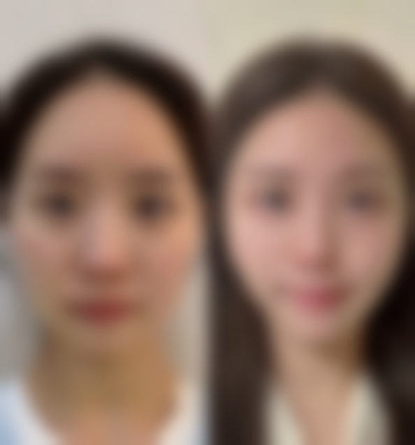 北京李医生整形医疗美容诊所真实实例