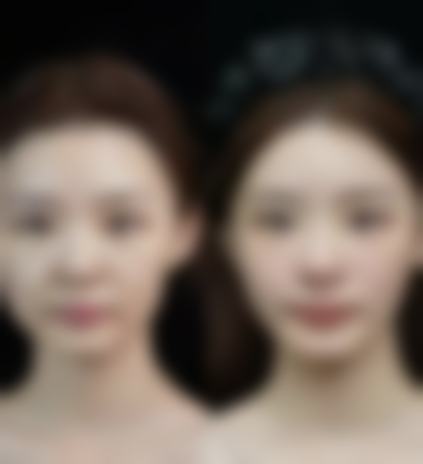 武汉斯启诺医美仪器抗衰预约挂号方式指南