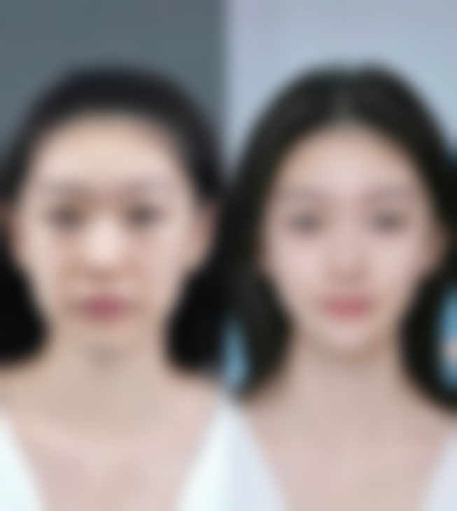 广州李挺医生真实实例展示