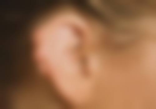 成都素美去除黑眼圈眼袋值不值