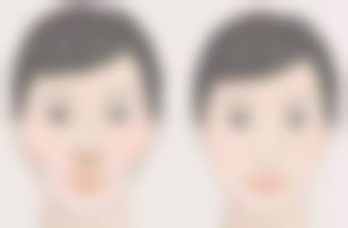 北京圣嘉新医疗美容医院隆胸修复靠谱吗？