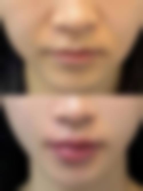 哈尔滨东江医院女性私密整形专科电话号码