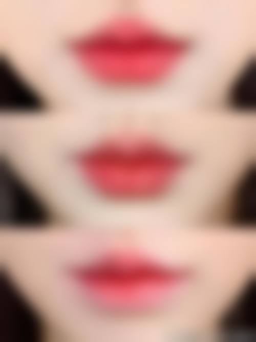 东莞雍禾医疗美容门诊部真实实例