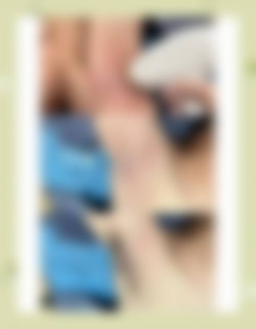 十堰亚美达医疗美容整形仪器设备：精良科技助力变得更美