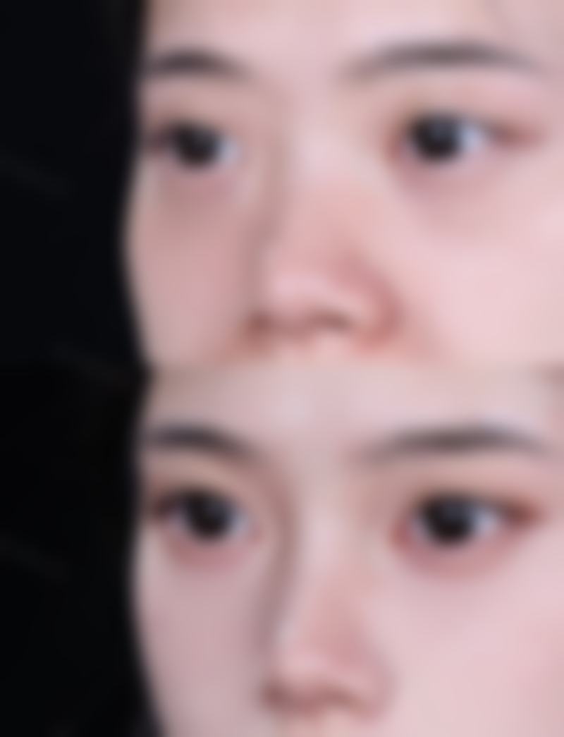 杨柳清医生擅长项目