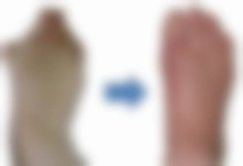 李虎星医生真实实例