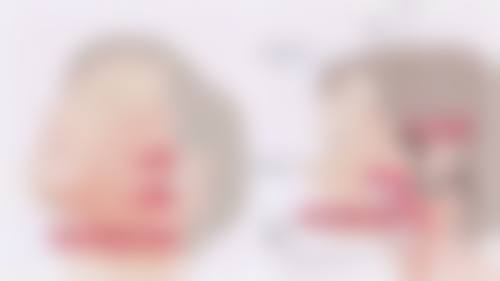 种头发原理头发种植在韩国清潭美乐皮肤科靠谱吗