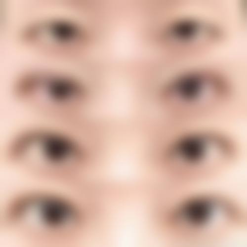 长春于艳医疗美容诊所真实实例