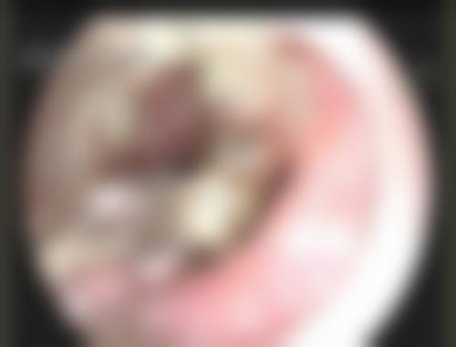 北京医 科院附属昆明时光整形真实实例