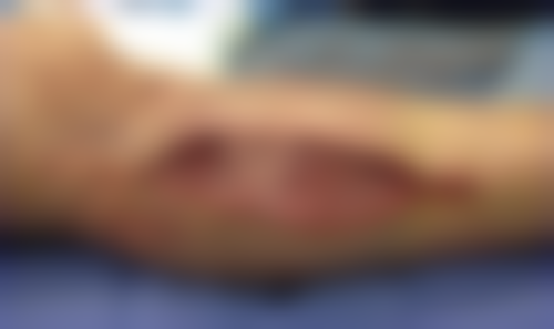 韩国QUEENS POSSOM整容外科擅长项目及Queensboro Oral Surgery特色项目