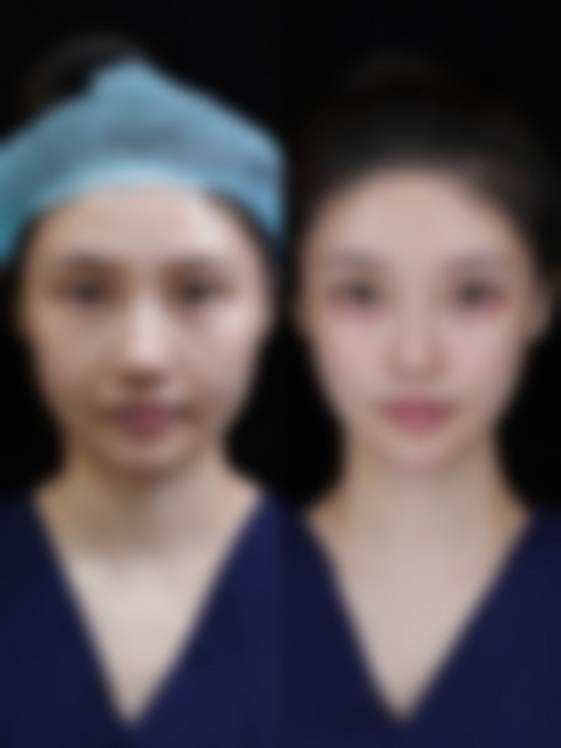 种头发原理头发种植在韩国alive皮肤科适合吗