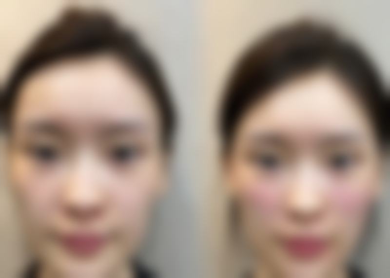 南宁亚韩整形美容医院医生名单