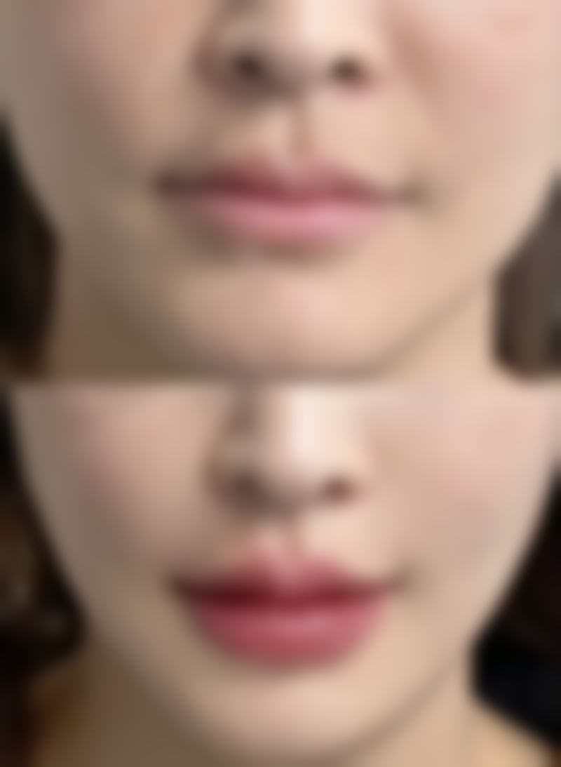 陶小风医生看诊优势