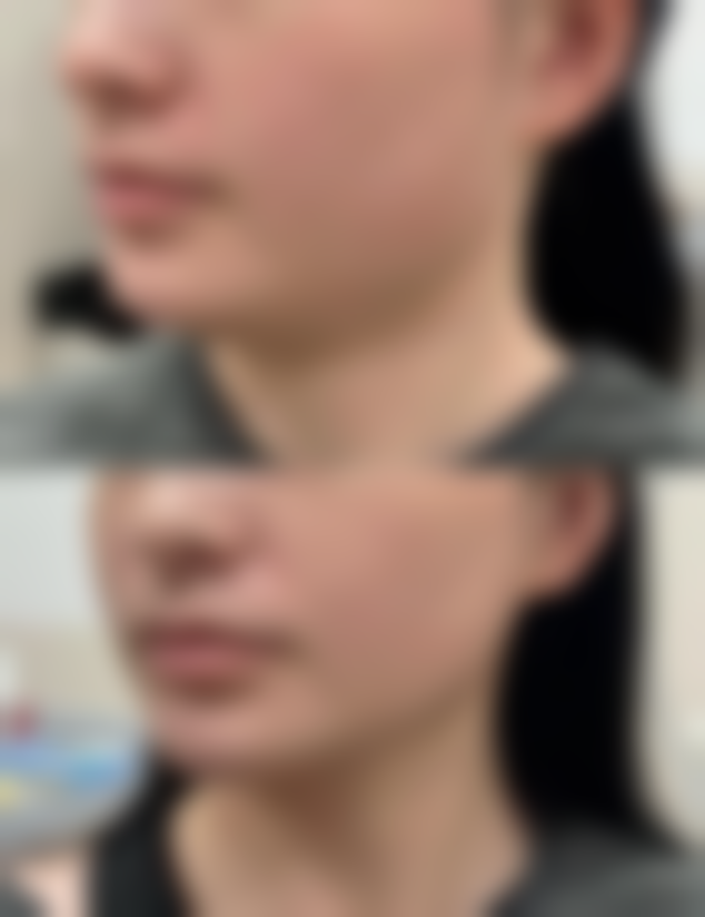 韩国QUEENS POSSOM整容外科真实实例及Queensboro Oral Surgery成功故事