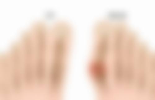 刘敏先医生擅长项目