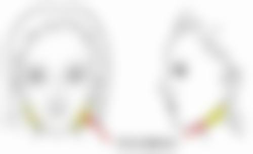 北京圣嘉新医疗美容医院割完双眼皮吃薯片值不值