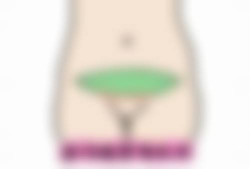 7.5毫米双眼皮术后修复要多久