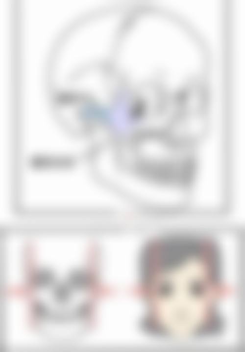 北京圣嘉新医疗美容面部吸脂忌口期吃鸡蛋适合吗?