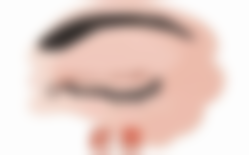 林开金医生真实实例