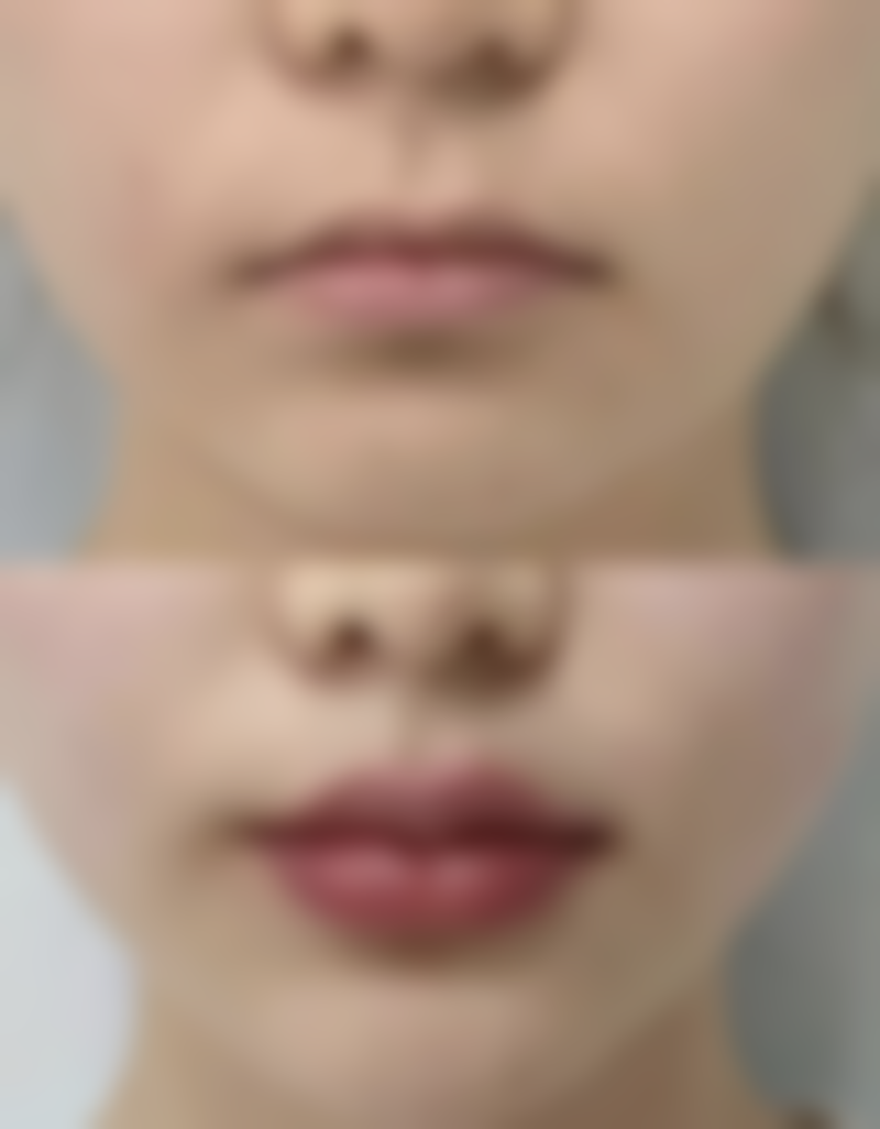 刘敏先医生怎么预约挂号