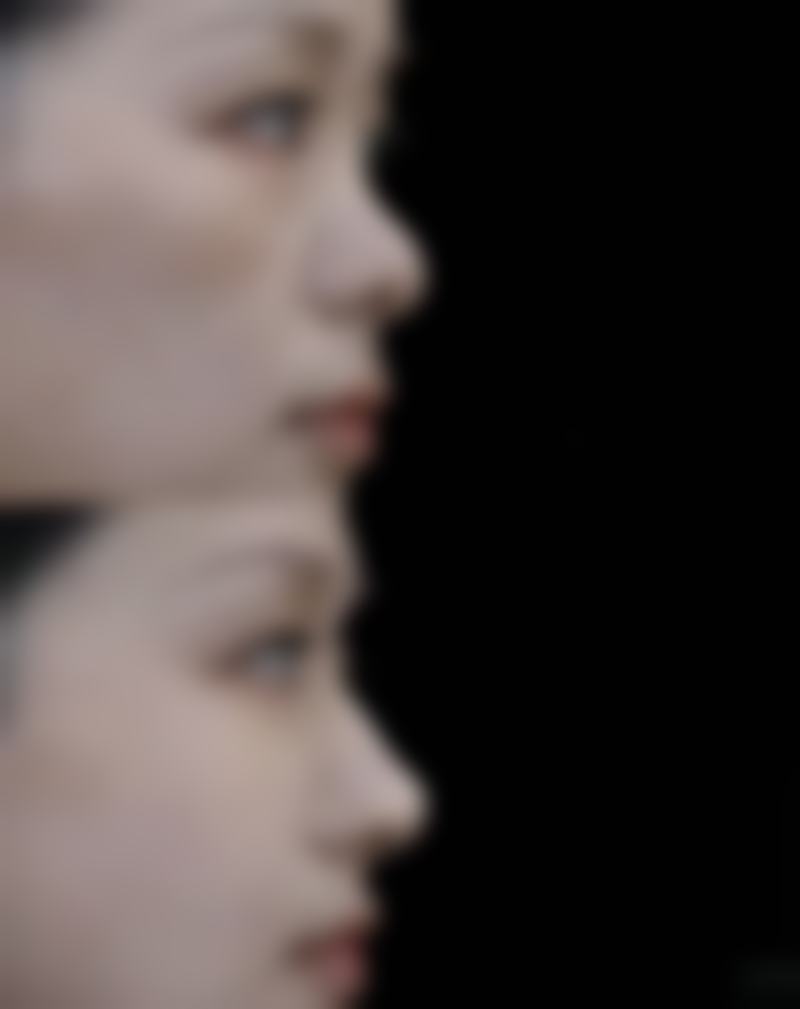 北京画美医疗美容割完双眼皮吃薯片靠谱吗