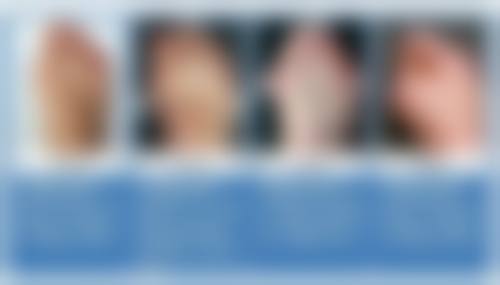 北京嘉和医疗美容医院对孩子身上疤痕不同时间修复成效怎么样？