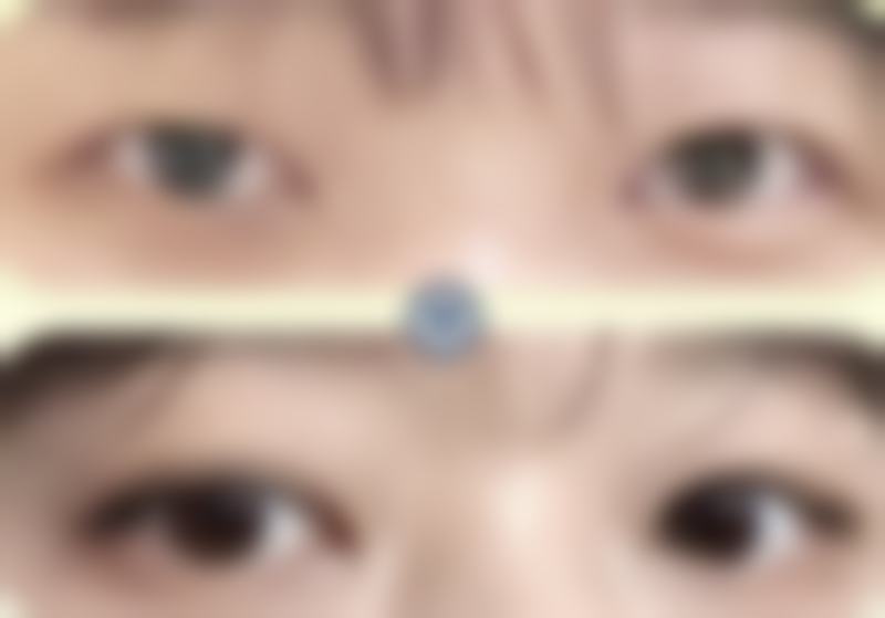 武汉斯启诺医美眼袋整形的口碑评价