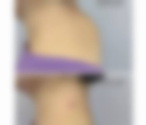 乌鲁木齐阐艺美医疗美容门诊部擅长项目