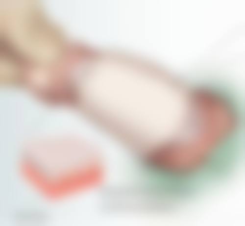 王学亚医生技术特点